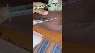 Blood🩸Sample  Taking Blood Sample  bloodsample nursing medical shorts short viral nurses [upl. by Enaenaj126]