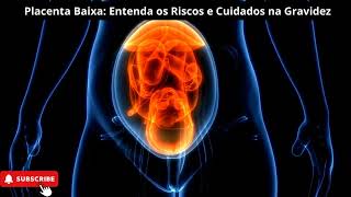 Placenta Baixa Entenda os Riscos e Cuidados na Gravidez [upl. by Inaluahek]