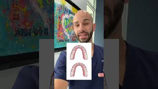 Invisalign to fix overcrowded upper teeth [upl. by Toney]