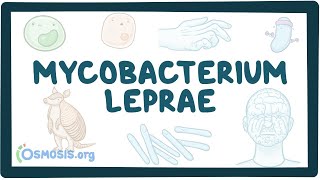 Mycobacterium leprae  an Osmosis Preview [upl. by Maye744]