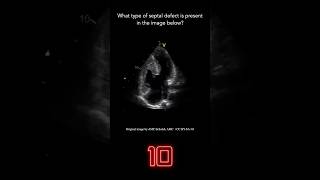 Echocardiography Question 7 [upl. by Latsyrk846]