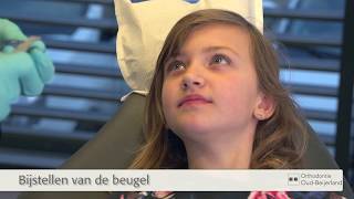 Controle van een uitneembare beugel  Orthodontie OudBeijerland [upl. by Ahsir]