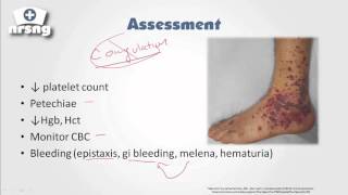 Thrombocytopenia NCLEX® Review  NRSNGacademycom [upl. by Serle]