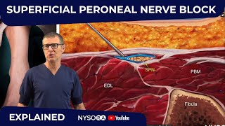 Superficial Peroneal Nerve Block  Crash course with Dr Hadzic [upl. by Gilberta622]