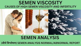 VISCOSITY OF SEMEN [upl. by Violetta121]