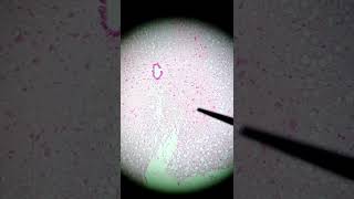 ¿Cómo se ve una motoneurona en microscopio  motoneurona  neurona histología histologia neurona [upl. by Etessil]