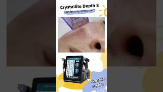 Arfurla Morpheus8 microneedle rf machine portable handles cold hammer skin rejuvenation [upl. by Ekyt]