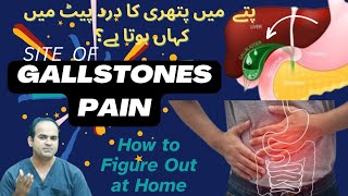 Gallbladder Stone Pain Learn the Different Locations amp SelfAssessment [upl. by Susannah]