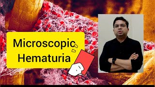 Microscopic Hematuria explained in Bengali [upl. by Radec]