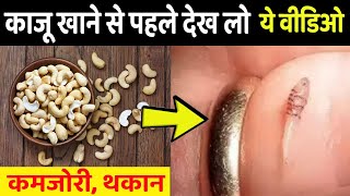 केवल 4 काजू खाली पेट खा लो फिर देखो कमाल दंग रह जाओगे  kaju khane ke fayde  Benefit Of Cashew [upl. by Gaidano]