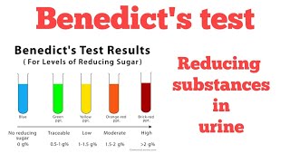 Benedicts test  Reducing substances in urine Biochemistry [upl. by Osi]