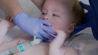 Changing a Tube on a Ventilated Child [upl. by Nihhi]