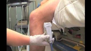 How To Deep Vein Thrombosis Detection with Ultrasound Part 1 Case Study Video [upl. by Vipul]