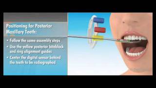 Dentsply Rinn XCPDS FIT Dentrek Module [upl. by Delphinia]