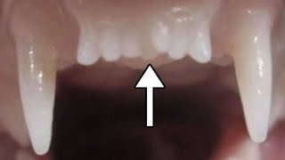 Worlds First Tooth Regrowing Drug Set To Start Human Trials [upl. by Ira]