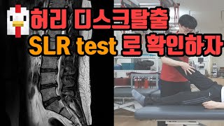 iamPT허리디스크탈출증을 검사하기 위한 SLR test를 정확하게 해보자 [upl. by Obbard328]