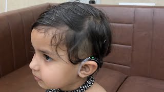 Cochlear Implant Switch on both ears Best Cochlear Implant Clinic in Punjab Simran  Audiologist [upl. by Clemmy226]