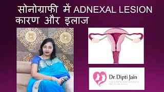 सोनोग्राफी में ADNEXAL LESION कारण और इलाज [upl. by Leakim]