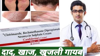 Candiderma Plus Cream for Fungal Infection  Clotrimazole amp Beclomethasone Dipropionate Cream [upl. by Daile]