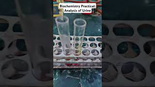 Biochemistry Practical Analysis of Urine for Urea and Creatinine in MBBS medico mbbs shorts [upl. by Chancellor]