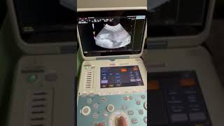 Esaote Ultrasound Demo Video [upl. by Barthel]