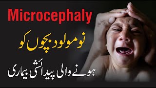 What Is The Microcephaly Condition  By Dr Khalid Jameel Akhtar [upl. by Enrak]