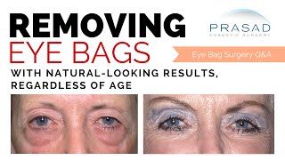 NaturalLooking Eye Bag Removal Surgery at Any Age  Not Removing Eyelid Skin is Key [upl. by Netsud]