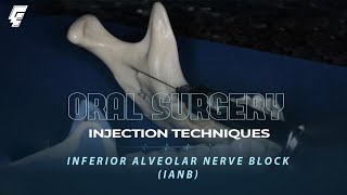 injection techniques 2  inferior alveolar nerve block  oral surgery  عزت شومان [upl. by Rengia]