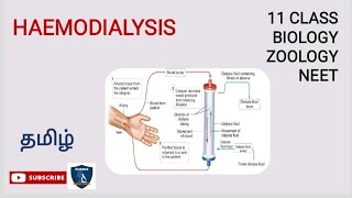 Haemodialysis in Tamil  Excretion  Zoology  Class 11  TNSCERT  NEET  Science Easy Tech [upl. by Dunston803]