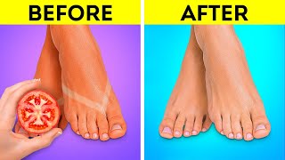 Foot Care Hacks 🦶👣 Smart Hacks To Keep Your Feet Nice And Smooth [upl. by Dnob]