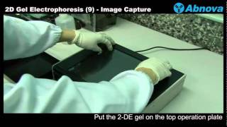 2D Gel Electrophoresis 9 Image Capture  UV Light Box [upl. by Jobie343]