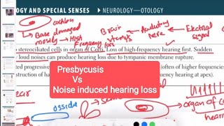 presbycusis Vs noise induced hearing loss otorhinolaryngology 4  First Aid USMLE Step 1 in Urdu [upl. by Yoho]