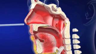 Nasogastric eLearning from Vygon UK Ltd [upl. by Nollaf889]