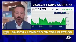 Bausch  Lomb CEO on strength in eye care competitive positioning [upl. by Keary]