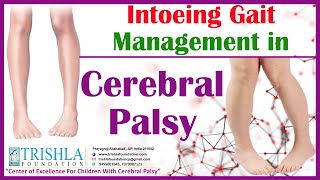 Intoeing Gait Management in Cerebral Palsy  Trishla Foundation [upl. by Ayek833]