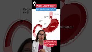 Peptic Ulcers Medical Surgical SHORT  LevelUpRN [upl. by Geldens807]