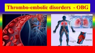 THROMBOEMBOLIC DISORDERS  Define  Puerperium  management  care of mothers  OBG [upl. by Valer72]