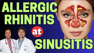 Allergic Rhinitis at Sinusitis  Payo ni Doc Gim Dimaguila ENT Doctor at Doc Willie Ong [upl. by Rurik625]