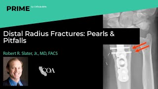 Distal Radius Fractures Pearls amp Pitfalls  Robert R Slater Jr MD FACS [upl. by Prowel]