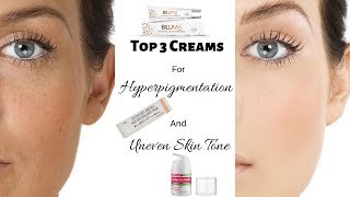 Top 3 Creams For Hyperpigmentation Uneven Skin Tone and Dull Skin  Rabia Skin Care [upl. by Blunt381]