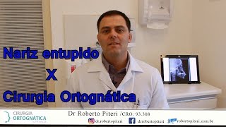 Nariz entupido X Cirurgia Ortgnática Dr Roberto Piteri explica causa e tratamento [upl. by Rochester894]