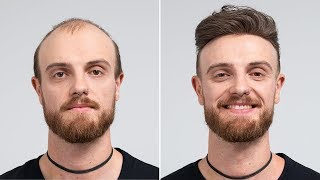 Berlin Street Style Haircut  Transformation with hair system  Hairsystems Heydecke [upl. by Bendite]