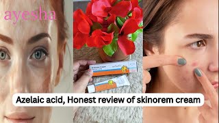 How to Use Azelaic Acid 20 benefits of azelaic acid Skinoren Cream Review in Pakistan [upl. by Anidal]