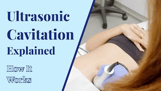 How Does Ultrasonic Cavitation Work  Body Treatments at BYou Laser Clinic in NYC [upl. by Pimbley706]