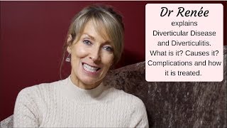 Diverticular Disease  what it is and what are the many complications [upl. by Teirrah]