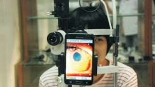 SmartPhone Slit Lamp Adapter [upl. by Anwahsit]