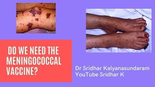 Meningococcal vaccinedo we need to give and when do we give it Dr Sridhar Kalyanasundaram [upl. by Raimundo]