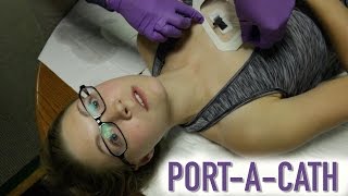 HOW TO ACCESS A PORTACATH IMPLANTED PORT [upl. by Raffaj]