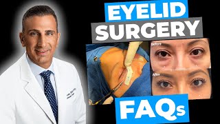 Everything You Need to Know About Eyelid Surgery  Expert Insights Before and After Recovery FAQs [upl. by Araiet]