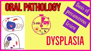 Differences Between DCIS and Invasive Breast Cancer [upl. by Aneerbas]